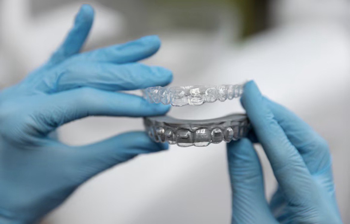 Krystal Aligners Details